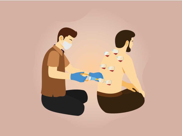 الحجامة العلاجية وفوائدها